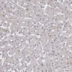 Immunohistochemical staining of human liver shows no positivity in hepatocytes as expected.