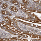 Immunohistochemical staining of human duodenum shows strong cytoplasmic positivity in glandular cells.