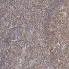 Immunohistochemical staining of human tonsil shows moderate cytoplasmic positivity in non-germinal center cells.