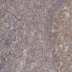 Immunohistochemical staining of human tonsil shows moderate cytoplasmic positivity in non-germinal center cells.