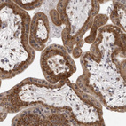 Immunohistochemical staining of human placenta shows strong cytoplasmic positivity in trophoblastic cells.