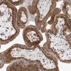 Immunohistochemical staining of human placenta shows strong cytoplasmic positivity in trophoblastic cells.