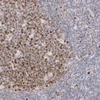 Immunohistochemical staining of human tonsil shows strong nuclear positivity in germinal center cells.