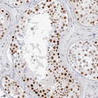 Immunohistochemical staining of human testis shows strong nuclear positivity in cells in seminiferous ducts.