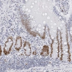 Immunohistochemical staining of human duodenum shows strong nuclear positivity in glandular cells.