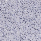 Immunohistochemical staining of human pancreas shows no positivity in exocrine glandular cells as expected.