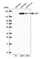 Western blot analysis in U2OS cells transfected with control siRNA, target specific siRNA probe #1 and #2, using Anti-NASP antibody. Remaining relative intensity is presented.