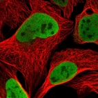 Immunofluorescent staining of human cell line U-2 OS shows localization to nucleoplasm.