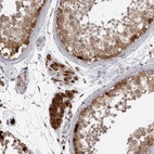 Anti-RTCA Antibody