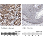 Anti-PLEKHA6 Antibody