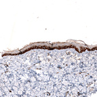 Immunohistochemical staining of human skin shows strong membranous positivity in squamous epithelial cells.