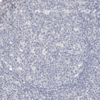 Immunohistochemical staining of human lymphoid tissues shows no positivity in germinal center cells as expected.