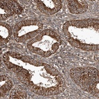 Immunohistochemical staining of human endometrium shows high expression.