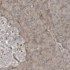 Immunohistochemical staining of human pancreas shows low expression as expected.