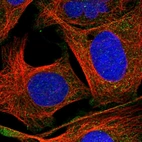 Immunofluorescent staining of human cell line U-2 OS shows localization to cytosol.