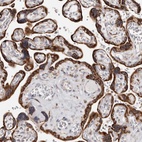 Anti-ACBD6 Antibody