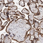 Anti-ACBD6 Antibody
