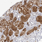 Immunohistochemical staining of human kidney shows strong cytoplasmic positivity in cells in tubules.