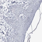 Immunohistochemical staining of human skin shows no positivity in squamous epithelial cells as expected.