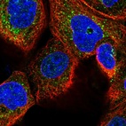 Immunofluorescent staining of human cell line A-431 shows localization to vesicles.