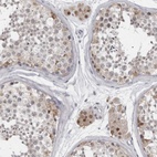 Anti-LZIC Antibody