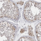 Anti-LZIC Antibody