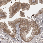 Immunohistochemical staining of human prostate shows moderate cytoplasmic and membranous positivity in glandular cells.