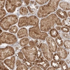Immunohistochemical staining of human kidney shows moderate cytoplasmic granular positivity in cells in tubules.