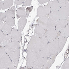 Immunohistochemical staining of human skeletal muscle shows no positivity in myocytes as expected.