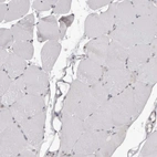 Immunohistochemical staining of human skeletal muscle shows no positivity in myocytes as expected.
