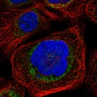 Immunofluorescent staining of human cell line A-431 shows localization to mitochondria.