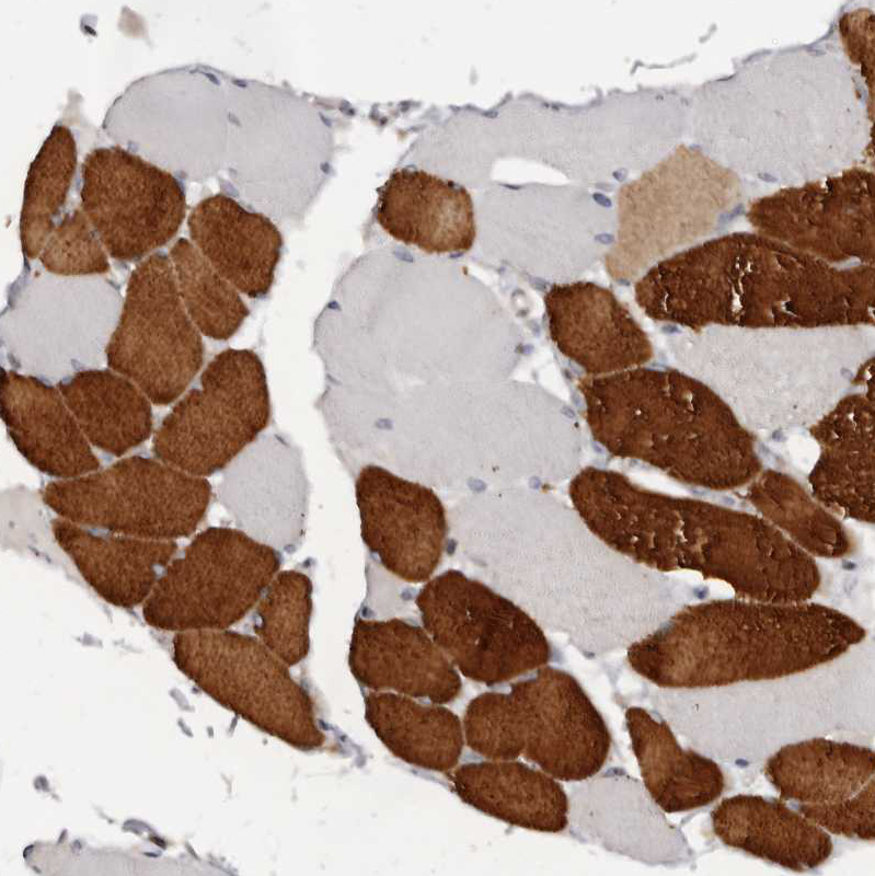 Anti-TNNI1 Antibody
