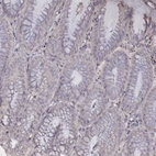 Immunohistochemical staining of human Stomach shows no cytoplasmic positivity in glandular cells as expected.