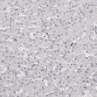 Immunohistochemical staining of human Liver shows no cytoplasmic positivity in hepatocytes as expected.