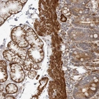 Immunohistochemical staining of human duodenum shows moderate to strong cytoplasmic positivity in glandular cells.