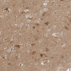 Immunohistochemical staining of human cerebral cortex shows moderate to strong cytoplasmic positivity in neurons.