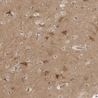 Immunohistochemical staining of human cerebral cortex shows moderate to strong cytoplasmic positivity in neurons.