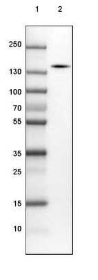 Lane 1: Marker [kDa] 250, 130, 100, 70, 55, 35, 25, 15, 10_br/_Lane 2: Human cell line SK-MEL-30
