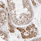 Immunohistochemical staining of human Testis shows moderate nuclear and cytoplasmic positivity in Leydig cells and cells in seminiferous ducts.