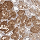 Immunohistochemical staining of human Kidney shows moderate nuclear and cytoplasmic positivity in cells in distal tubules.