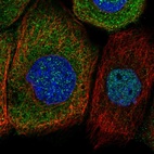 Immunofluorescent staining of human cell line A-431 shows localization to nucleoplasm & cytosol.