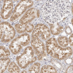 Immunohistochemical staining of human kidney shows moderate cytoplasmic positivity in cells in tubules.