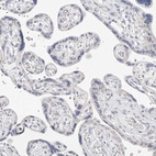 Immunohistochemical staining of human placenta shows no cytoplasmic positivity in trophoblastic cells as expected.