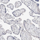 Immunohistochemical staining of human placenta shows no cytoplasmic positivity in trophoblastic cells as expected.