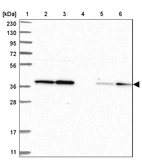 Lane 1: Marker [kDa] 230, 130, 95, 72, 56, 36, 28, 17, 11_br/_Lane 2: Human cell line RT-4_br/_Lane 3: Human cell line U-251MG sp_br/_Lane 4: Human plasma (IgG/HSA depleted)_br/_Lane 5: Human liver tissue_br/_Lane 6: Human tonsil tissue