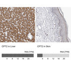 Anti-CPT2 Antibody