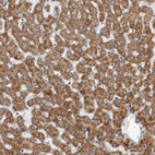 Immunohistochemical staining of human liver shows moderate granular cytoplasmic in hepatocytes.