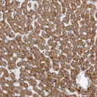 Immunohistochemical staining of human liver shows moderate granular cytoplasmic in hepatocytes.