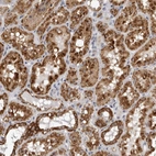 Immunohistochemical staining of human kidney shows strong granular cytoplasmic positivity in cells in tubules.