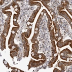 Immunohistochemical staining of human duodenum shows strong granular cytoplasmic positivity in glandular cells.